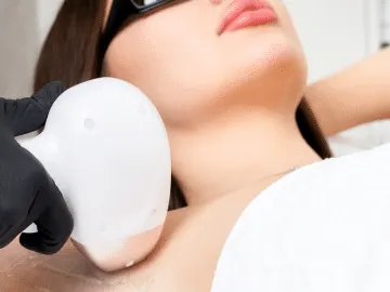 Stock photograph of models: a gloved clinician treats a woman’s underarm with a laser hair removal handpiece