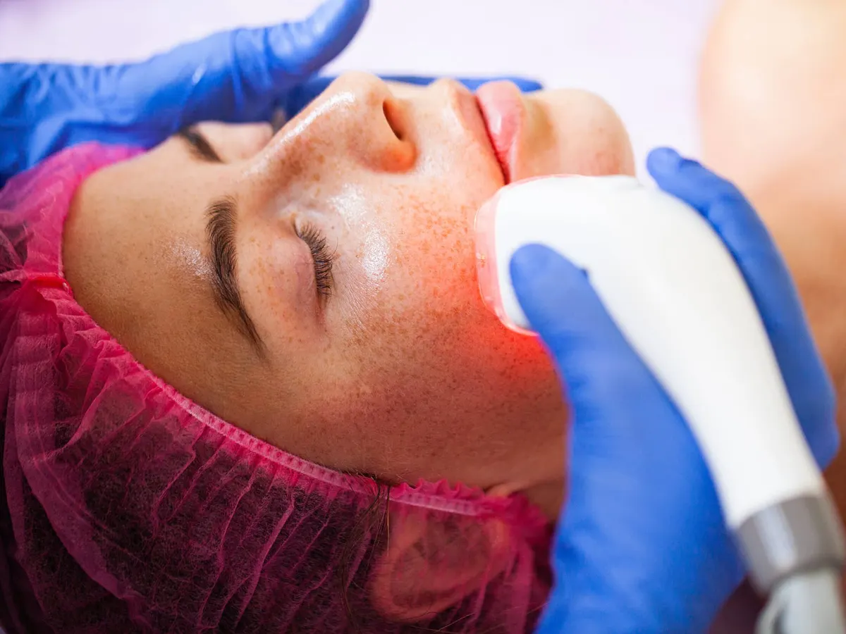 Stock photograph of models: a freckled woman in a pink hair cap lies back while a gloved clinician passes a handheld device with a red light over her cheek