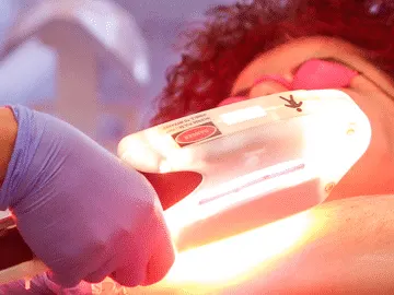 Stock photograph of models: a gloved clinician holds a glowing light-therapy handpiece over a patient wearing eye shields