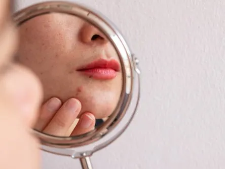 Stock photograph of a model: a woman checks a blemish on her chin in a hand mirror