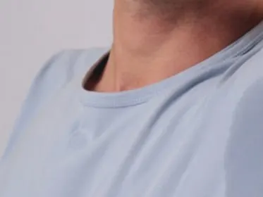 Stock photograph of a model: a man raising one arm to show a dark damp patch under the armpit of his light blue T-shirt.