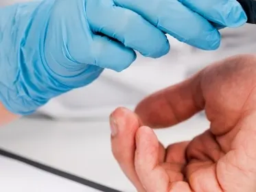 Stock photograph of a model: gloved hands hold a magnifying glass over a person’s wrist and hand that show scaly pink patches.