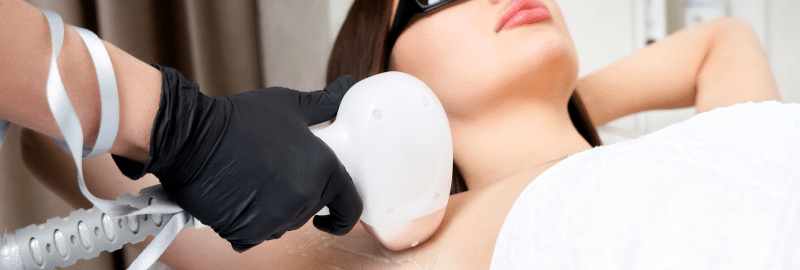 Stock photograph of models: a gloved clinician treats a woman’s underarm with a laser hair removal handpiece