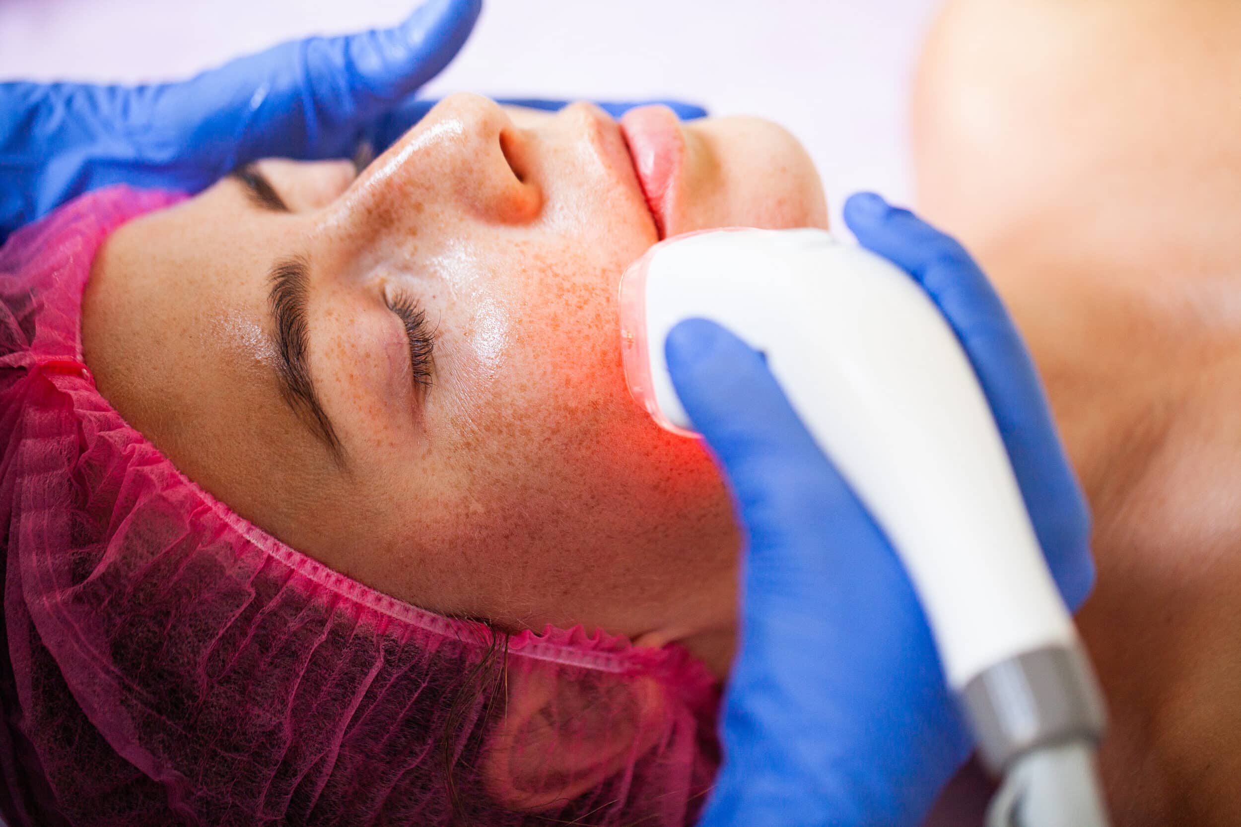 Stock photograph of models: a freckled woman in a pink hair cap lies back while a gloved clinician passes a handheld device with a red light over her cheek