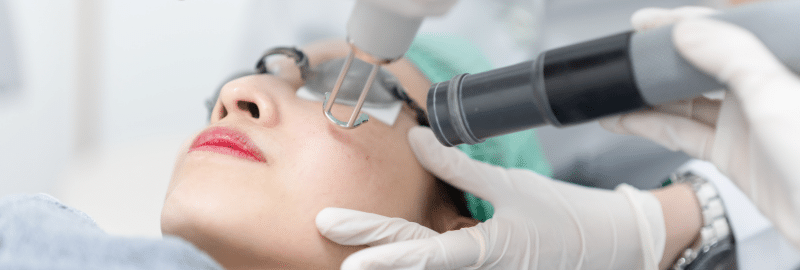Stock photograph of models: a gloved clinician holds a laser handpiece to the cheek of a woman who lies back wearing eye shields