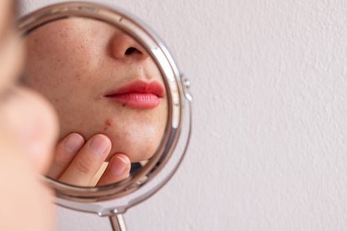 Stock photograph of a model: a woman checks a blemish on her chin in a hand mirror