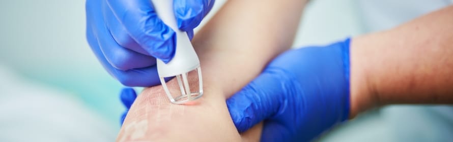 Stock photograph of a model: blue-gloved hands hold a small white handheld device with a grid tip against the skin of a person’s wrist.