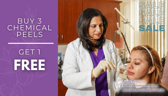 Promotional graphic: "Buy 3 Chemical Peels, Get 1 FREE" and "SALE" beside Dr. Nita Patel applying a peel to a woman’s face, with the Nita Patel, MD, Advance Dermatology & Laser Medical Center logo.